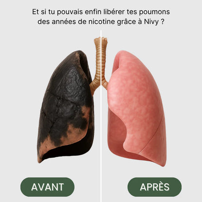 NIVORA™ – Stick Botanique Sans Nicotine