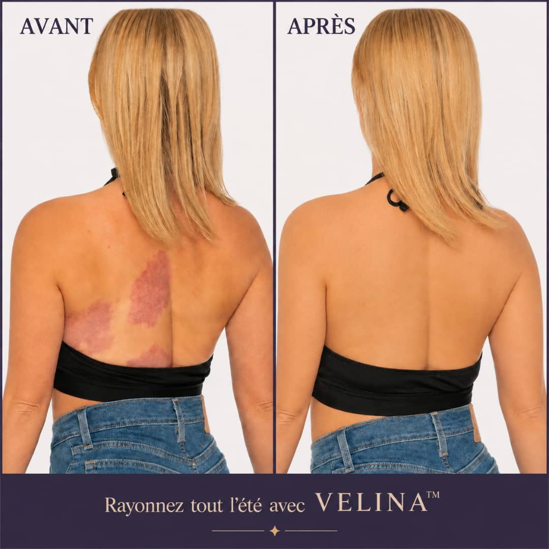Velina™  Révélez votre plus belle peau