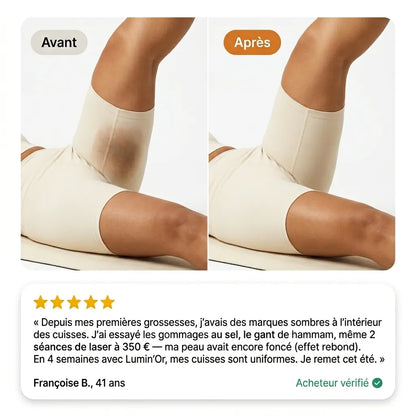 Luminéa™