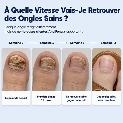 Mycovital™ | Huile d'Origan & de Nigelle – Élimine la Mycose des Ongles