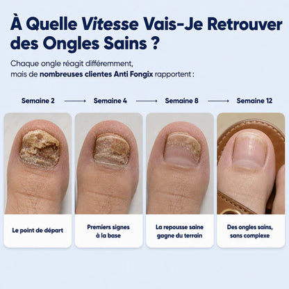 Mycovital™ | Huile d'Origan & de Nigelle – Élimine la Mycose des Ongles